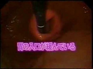 Japanese Endoscopy