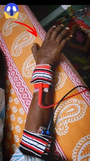 Paralyzed Side Activation! Muscle Stimulator LIVE Demo ⚡😳👇