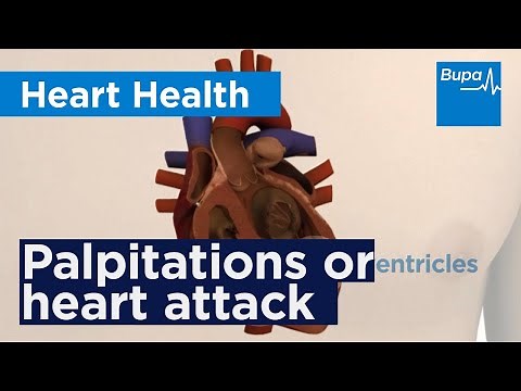 Palpitations or heart attack: what is it? | Bupa Health
