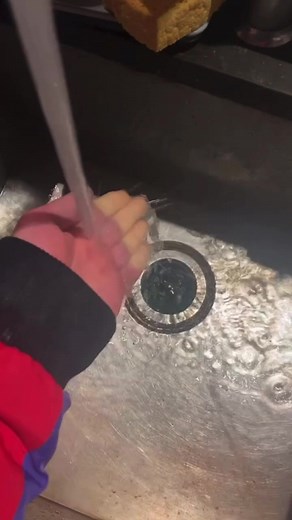 2.9K views · 40 reactions | Mystery finger pathology explained | LifeOfADoctor | Facebook