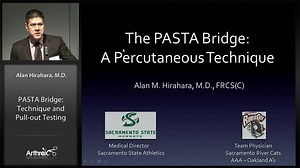 PASTA Bridge: Technique and Pull-out Testing