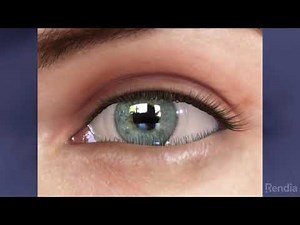 Entropion: Treatment Overview