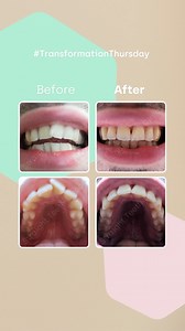 “My experience with Straight Teeth Direct has been nothing short of fantastic; excellent communication and support along the way and amazing results!”  Yaz Thank you for your kind words, Yaz! Here’s to many years enjoying your new smile  | Straight Teeth Direct | Facebook