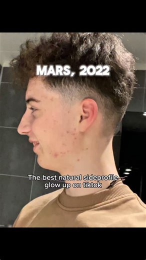 Emity on Instagram: "*No problem, here’s the detail (you won’t regret reading this): Ever heard of Project Emity™? It’s a full system I built — 12 transformation guides from Hair to Gym, Facial Structure to Skin, Height, Testosterone, and more. But I’m not giving it all away free. So here’s what I’ll do:* I’ll send you 1 full PDF for free If it hits — you’ll know this is legit. Steps to get it: 1️⃣ Follow @emity.max 2️⃣ Comment “MAXX” 3️⃣ DM this reel to me 4️⃣ I’ll send the free guide manually 