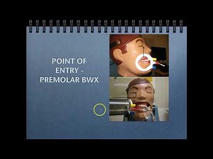 BWX Techniques, Evaluation & Mounting