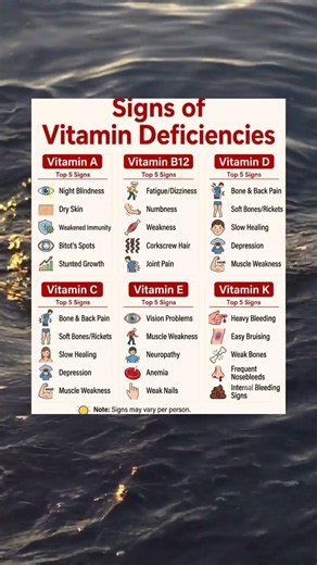 Top 5 Signs You are Vitamin Deficient B12, D3, C & More #vitaminddeficiency #wellness #healthyliving