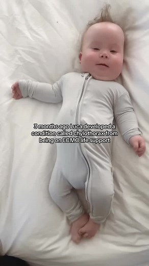 It feels like the end of an era, Chylothorax is the last piece of health issue that we have left of Luca’s, since our wild NICU journey… Let’s take a ride down memory lane. Luca had been in the NICU about six weeks, he had finished his ECMO run a few weeks prior and had taken a serious turn for the better. His pulmonary hypertension was gone and I began to see how we were going to be able to go home soon as be home for Christmas. I didn’t sleep that whole night I couldn’t wait to go in for round