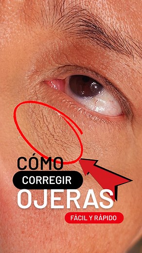 👉🏻COMO CUBRIR OJERAS CON MAQUILLAJE FÁCIL Y RÁPIDO 👈🏻 ❤️Te muestro todo lo que necesitas saber sobre cómo corregir ojeras SIN VERSE CARGADO. Algo que me costó asimilar por mucho tiempo es que HAY OJERAS QUE NO DEBEN SELLARSE CON POLVO en pro de lograr un mejor acabado. La piel tan delgada, líneas de expresión, resequedad… Son factores que influyen en el acabado del corrector ENTONCES te recomiendo siempre, sobre todo en pieles maduras, hacer una pequeña prueba rápida en la que ponemos el pro
