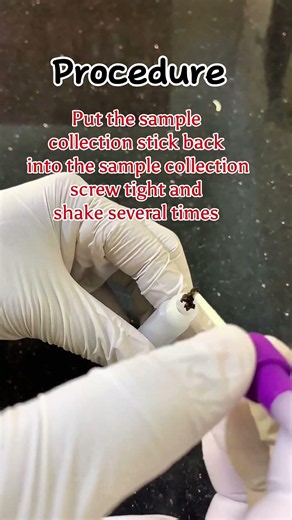 #How to Carry Out Grace Life RDT Fecal Occult Blood Test #fob #medlab