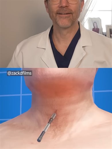 What Happens During A Tracheotomy 💉 Surgeon Reacts