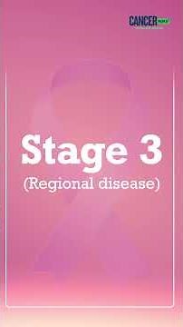 Demystifying Cancer Stages