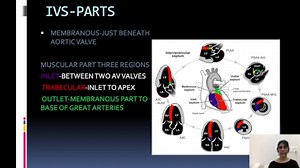 VENTRICULAR SEPTAL DEFECTS -An excerpt from class on congenital cardiac anomalies.... | Dr.Randhawa’s Institute of Ultrasound Training ,Delhi -Affiliate Jurei,USA