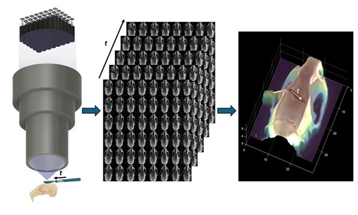 New surgical microscope offers precise 3D imaging using 48 tiny cameras