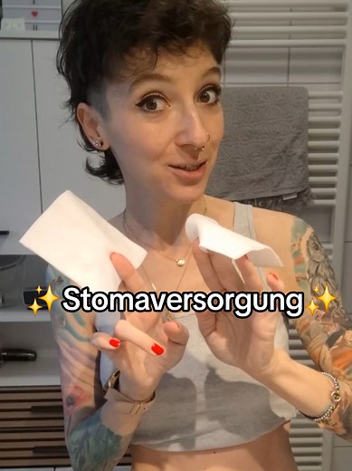 Stomaversorgung: Einblick in die Versorgung bei Morbus Crohn