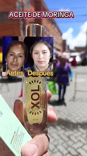 ACEITE DE MROINGA #moringa #aceitedemoringa #acnè #rosacea #manchas #manchasenlapiel #embarazo #embarazos #mujeres #papas