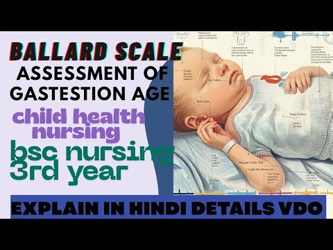 Ballard scale gastestional age assessment of new born child health nursing easy explanation in hindi