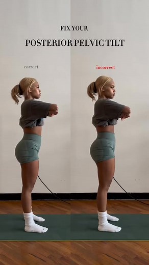2.1K views · 19 reactions | if u have a posterior pelvic tilt this ones for youuuu  lateral pelvic tilt exercises have already been uploaded! #FitTok #GymTok #posteriorpelvictilt #pelvictiltexercise | Esl.mov | Facebook