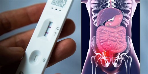 Scientists spot striking rise in gastrointestinal disorders with 'more severe' symptoms after pandemic