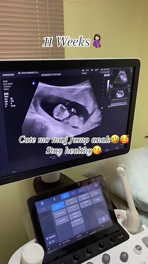 11 Weeks Ultrasound Baby Moving in Stomach | Cute Pregnancy Video