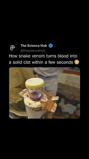 Snake venom can rapidly transform blood into a solid clot due to the presence of powerful enzymes known as procoagulants. These enzymes mimic or enhance the body’s natural clotting mechanisms, often in a much more aggressive and uncontrolled way. One common mechanism involves thrombin-like enzymes (TLEs), which convert fibrinogen—a soluble protein in blood plasma—into fibrin, an insoluble protein that forms the meshwork of a clot. Some snake venoms also contain factor X and prothrombin activator