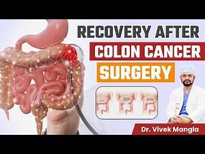 कोलन कैंसर सर्जरी के बाद Recovery | Recovery after Colon Cancer Surgery | Treatment of Colon Cancer