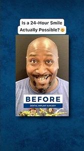 How I Got My New Smile in 24 Hours! 🦷