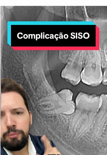 Parestesia Pós-Cirurgia: Causas e Tratamentos