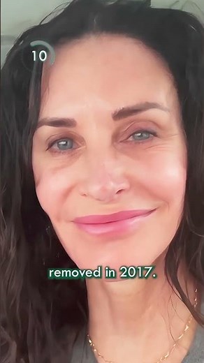The DARK Side Of Celebrity Plastic Surgery: Courtney Cox |