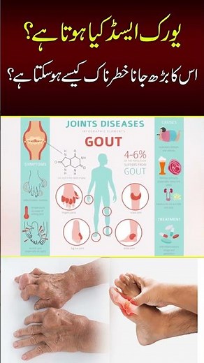 What is Uric Acid and Why It Matters for Your Health?