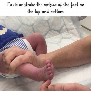 6K views · 68 reactions | Some babies with clubfooot have had to have their casting treatment paused due to COVID-19. This video, produced in partnership with Global Clubfoot Initiative shows simple movements and exercises that help to keep the feet moving and mobile. | Steps Charity | Facebook