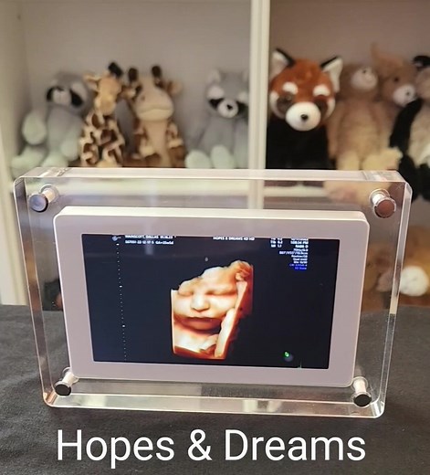 Digital Video Frames! Get yours today at Hopes & Dreams 3D4D Ultrasound. Atascadero & Santa Maria #3dultrasound #4dultrasound #Atascadero #SantaMaria #bestofthebest #wehavethebestfamilies #centralcoastmoms #viral?videotiktok😇😇