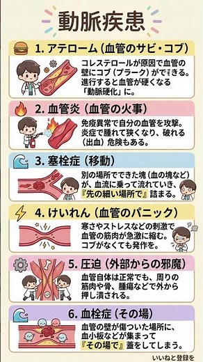 【血管の科学】動脈の中で何が起きてる？アテローム・血栓・けいれんの仕組みを図解！一生詰まらない血管を作るための基礎知識