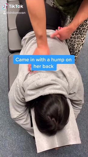 Chiropractor Demonstrates Bone Cracking: Who Else Has a 'Hump'?