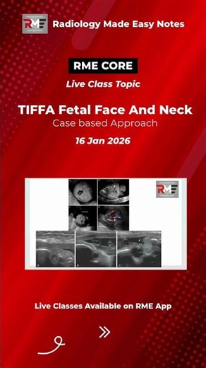 Radiology Live Class - TIFFA | FACE & NECK – COMPLETE SPECTRUM
