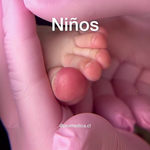 Tratamiento de uñas enterradas en bebés: consejos de podología infantil