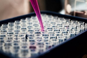 Decoding Your Herpes IgG Test: Understanding Results and Next Steps