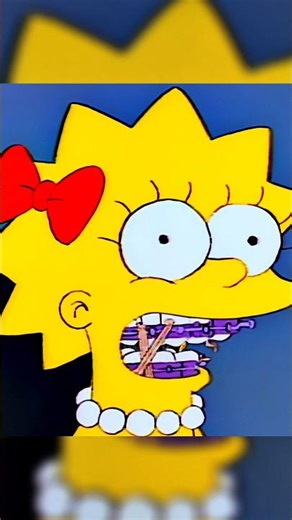 LISA HAD TO WEAR BRACES! #simpsons