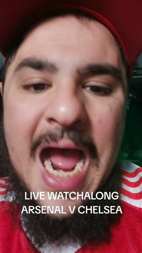 Arsenal v Chelsea LIVE WATCHALONG!! #arsenal