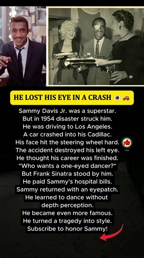 The accident that changed Sammy Davis Jr... 👁️🚗 #Shorts #respect #news #kindness #viral #rip