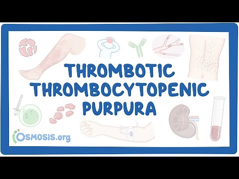 Thrombotic thrombocytopenic purpura (NORD)