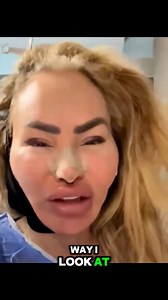 90 Day Fiance: Surgery in Turkey did not stop Darcey from giving her fans the came0s they ordered! Very sweet!‼️ #fblifestyle | 90 Day Fiancé Breaking News