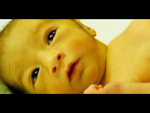 Signs of Pathologic Newborn Jaundice, Neonatal Jaundice, Hyperbilirubinemia Causes, Symptoms