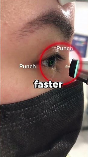 This Why People Love This Eye Test?!