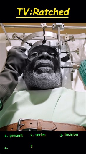 They Turn a Lobotomy Into a “Show”… and the Room Can’t Look Away 😨🧠🩺 #shorts #movie