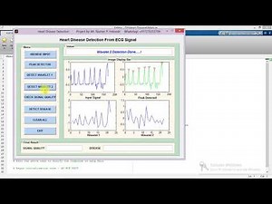 Matlab Code for Heart Disease Detection from ECG Signal
