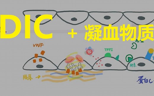 【病生三分钟】DIC：孕妇/感染DIC是什么？促凝/抗凝物质有哪些？组织因子有什么作用？（弥散性血管内凝血）