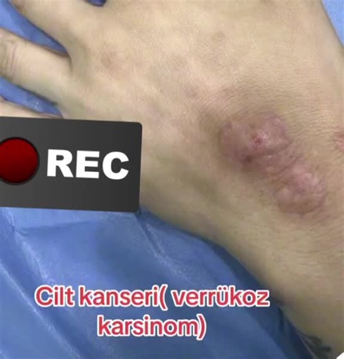 GENEL CERRAH.OP.DR. TikTok'ta