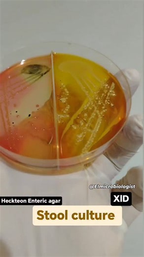 Stool Culture result on XLD, and HE agar Salmonella is detected. How to confirm the identification of Salmonella?? #Elmicrobiologist | Elmicrobiologist