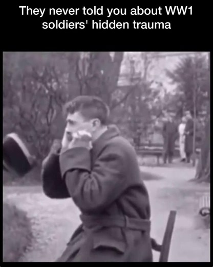 The Histologian on Instagram: "They never told you about WW1 soldiers' hidden trauma. Many of us have heard stories about the bravery of WW1 soldiers, but what about the scars they carried long after the war was over? Soldiers who returned from the first world war often suffered from what was then called shell shock. This condition left deep psychological scars due to constant artillery fire, trench warfare, and mass casualties. Without a modern understanding of trauma, these men were often misu