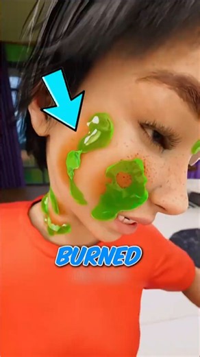 Boy Microwaved His Squishy Toy… Then It EXPLODED